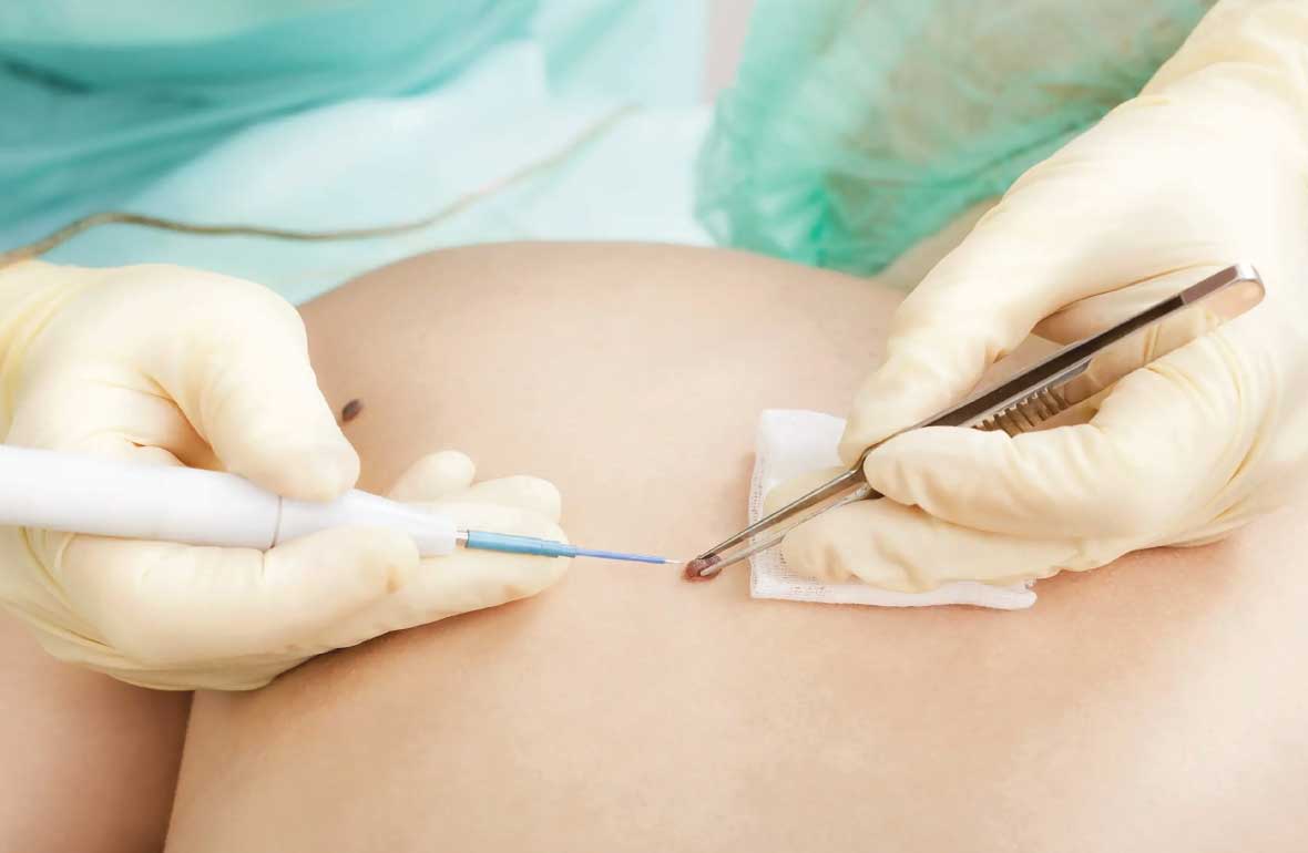 BEN ALDIRMA SONRASI İZLER