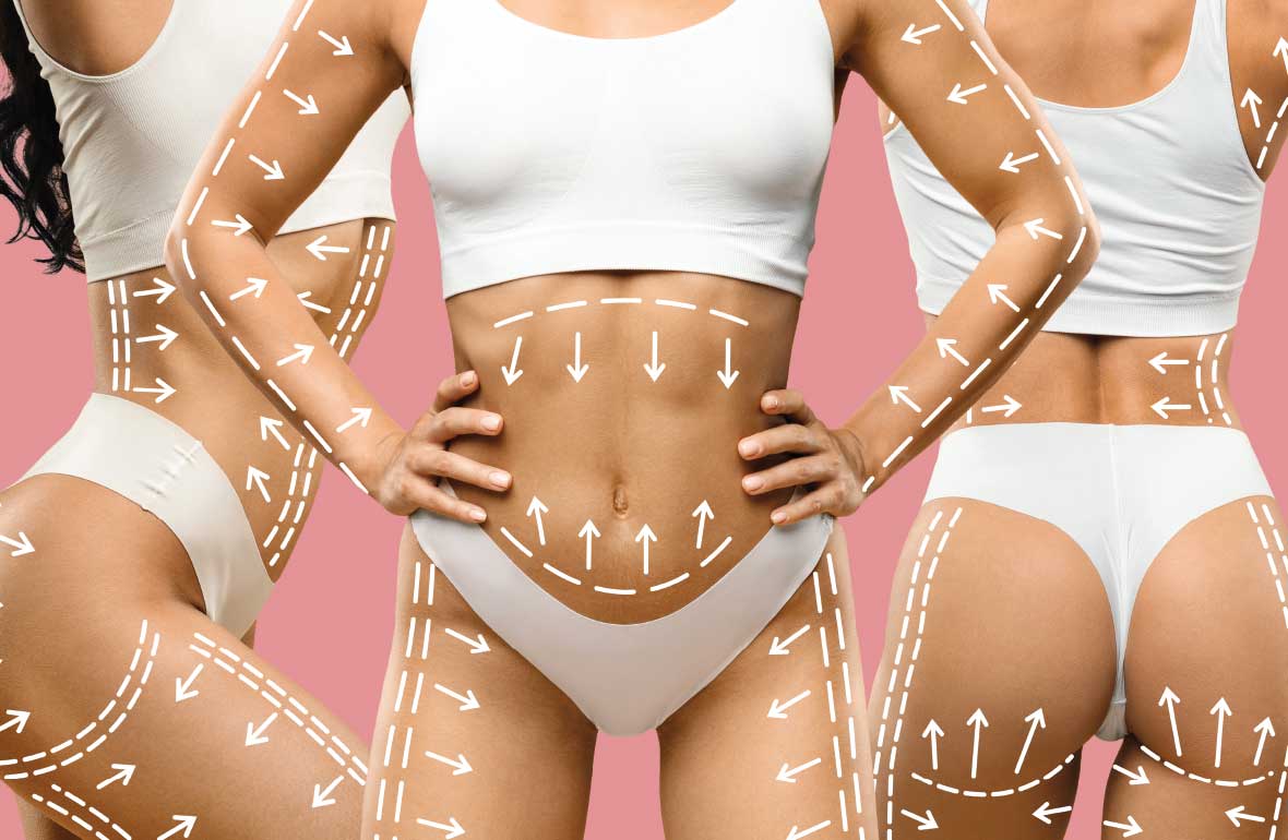 ESTETİK OPERASYONLAR ÖNCESİ VE SONRASI İZLER