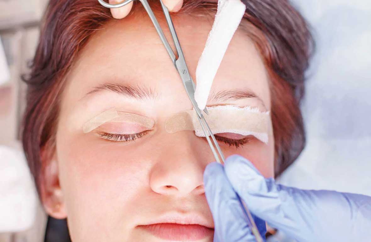 GÖZ KAPAĞI AMELİYATI