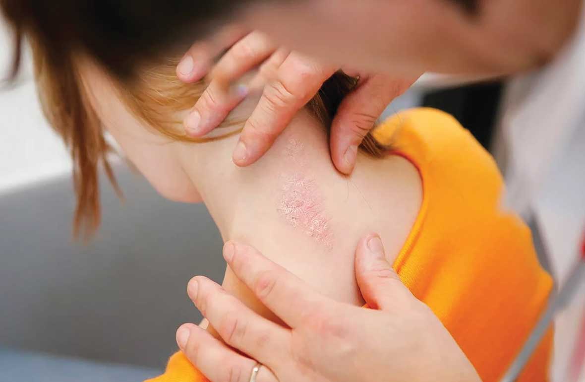 YANIK SONRASI İZLER